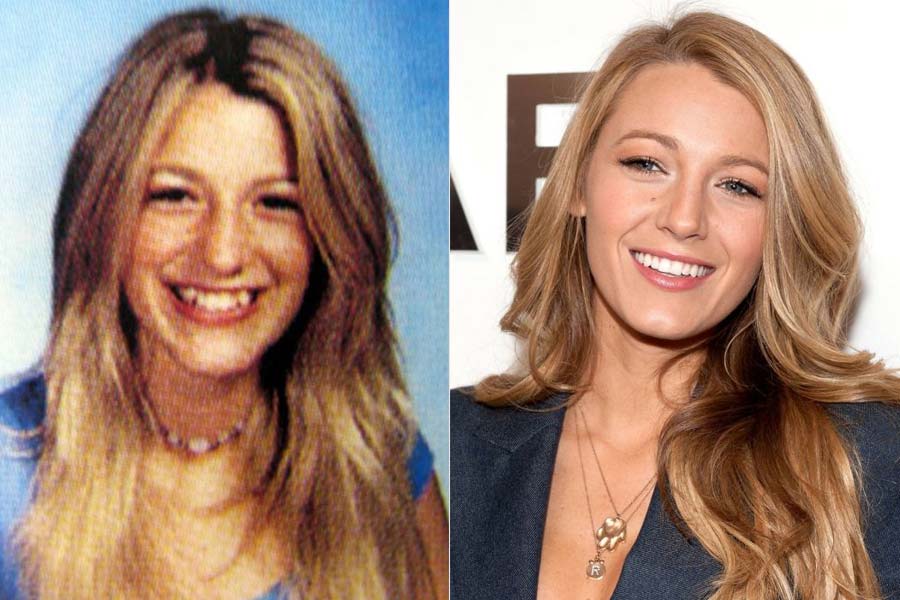 Blake Lively (Serena van der Woodsen)