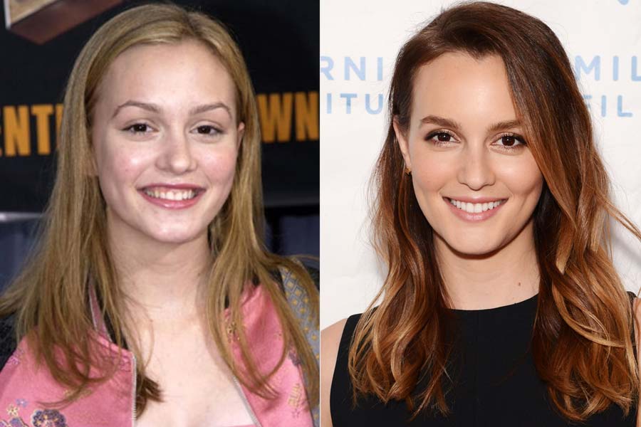 Antes e Depois - Infância do Elenco de Gossip Girl - Just Lia